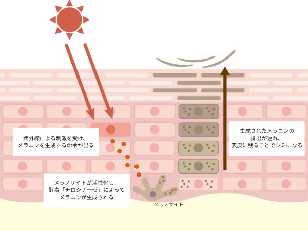 シミができるメカニズム解説画像
