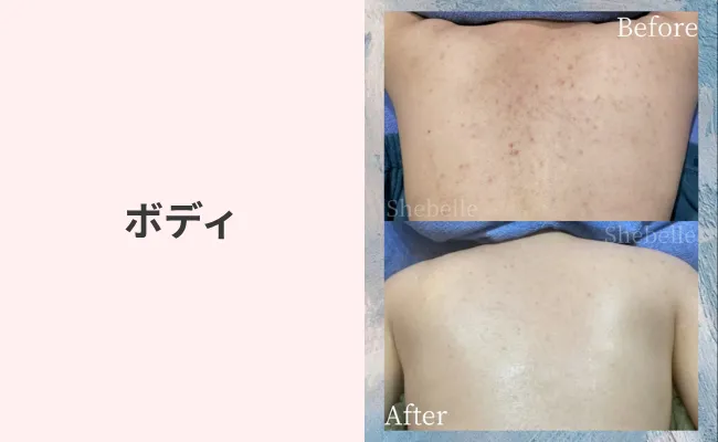 ボディの症例写真①