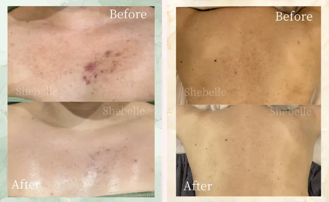 ボディの症例写真②