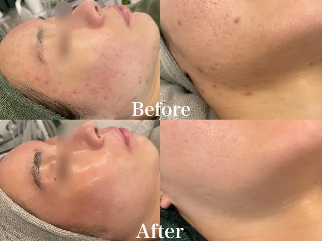 コンテスト1位の症例写真