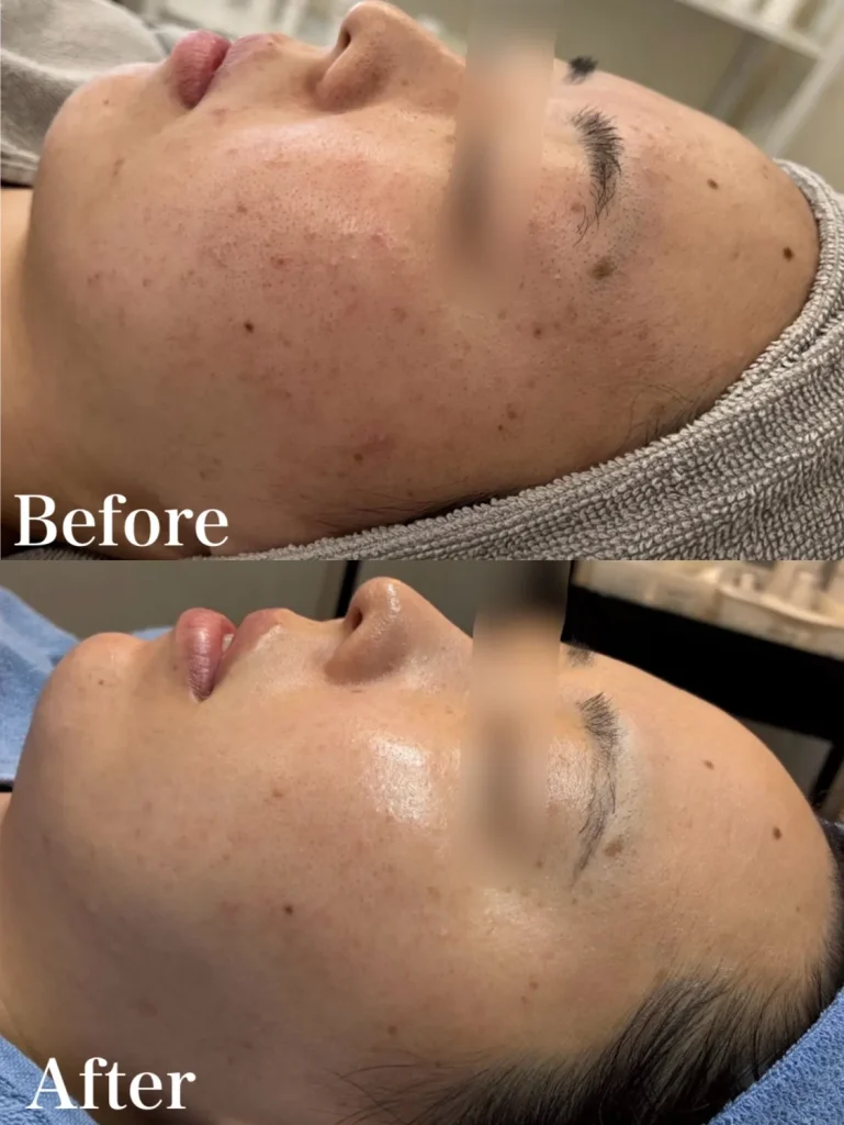 コンテスト2位の症例写真