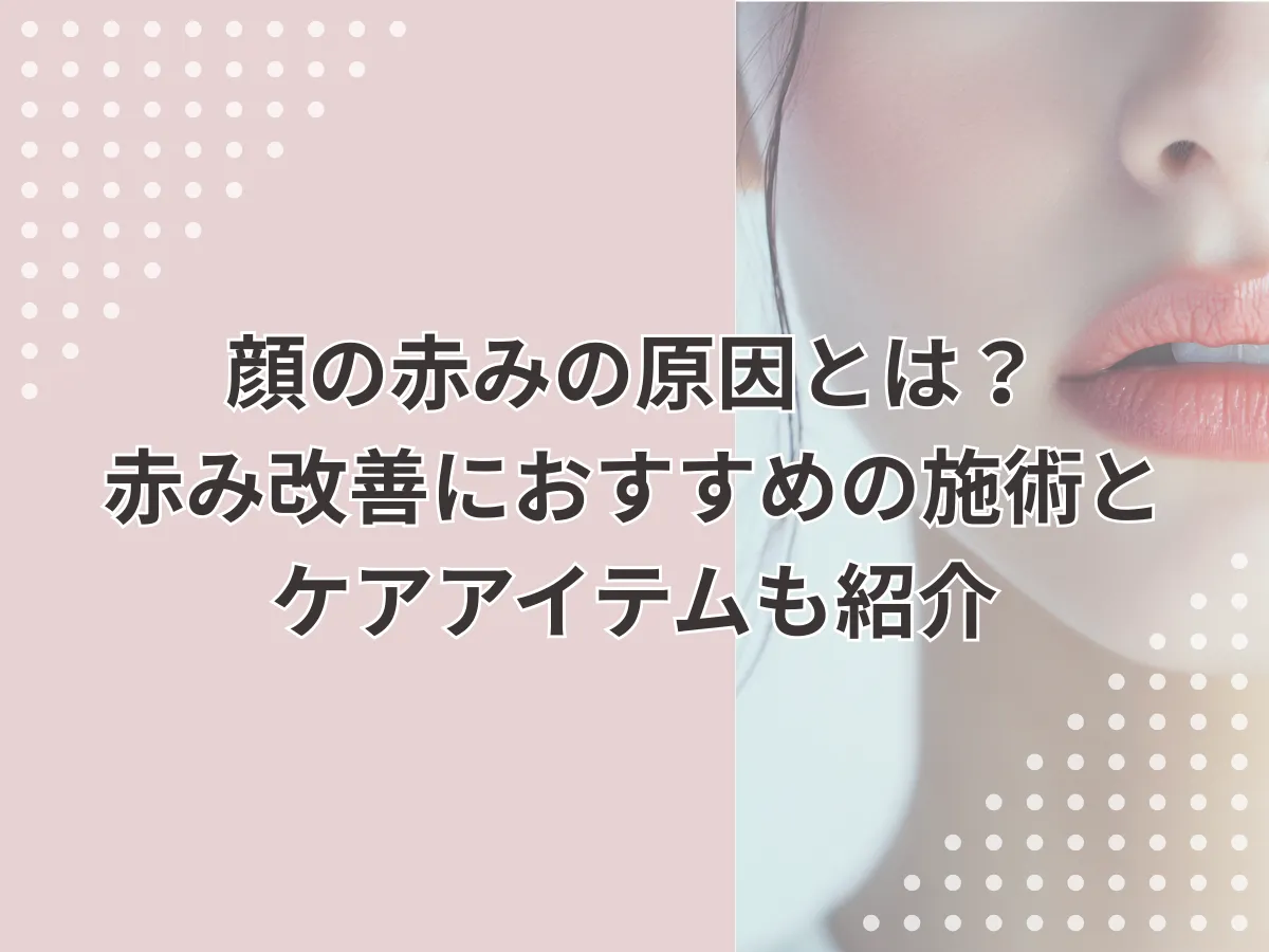 顔の赤みの原因とは？赤み改善におすすめの施術とケアアイテムも紹介のアイキャッチ