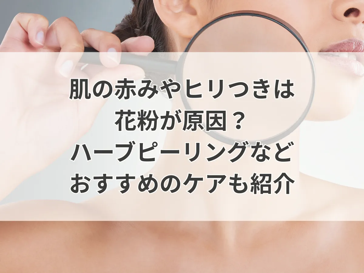 肌の赤みやヒリつきは花粉が原因？ハーブピーリングなどおすすめのケアも紹介