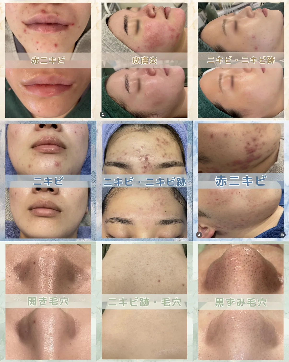 症例写真 Before / After